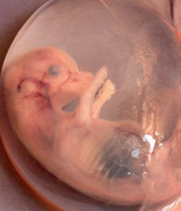 fetal programming