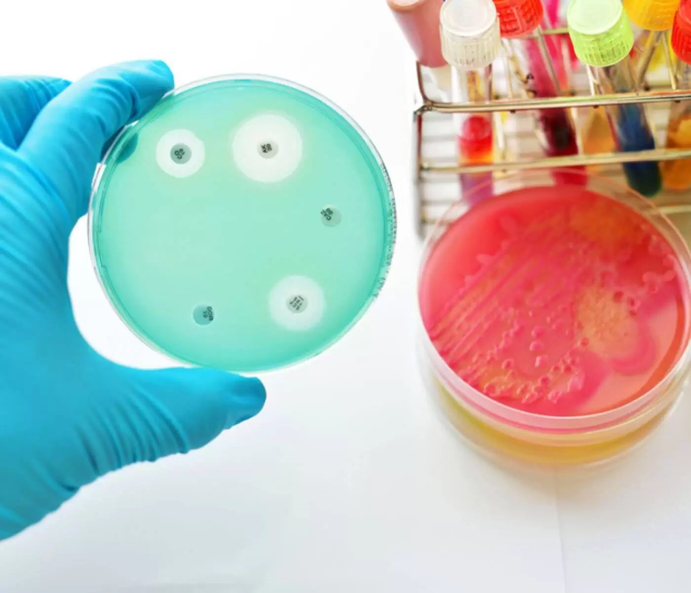 Bacterial resistance to highly used antibiotics: A worrying trend!
