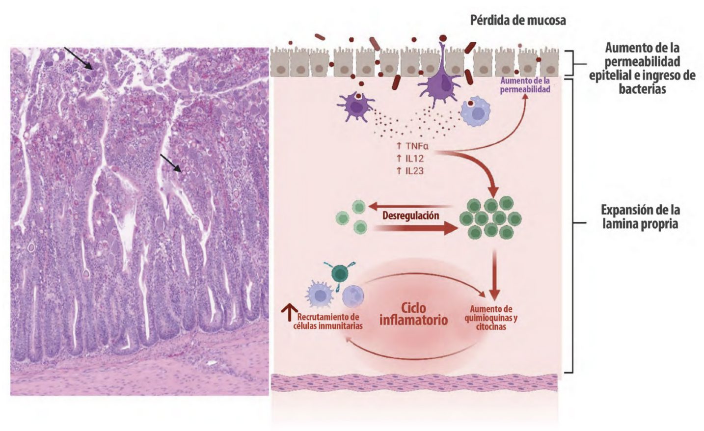 inflamación intestinal aves